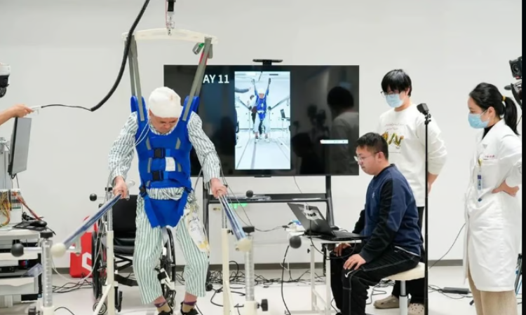 "Pacientes que perderam os movimentos devido a lesões na medula espinhal estão recuperando a mobilidade graças à tecnologia de interface cérebro-espinhal. Desenvolvida na China, essa inovação utiliza inteligência artificial para decodificar sinais cerebrais e estimular nervos espinhais, trazendo esperança para milhões."